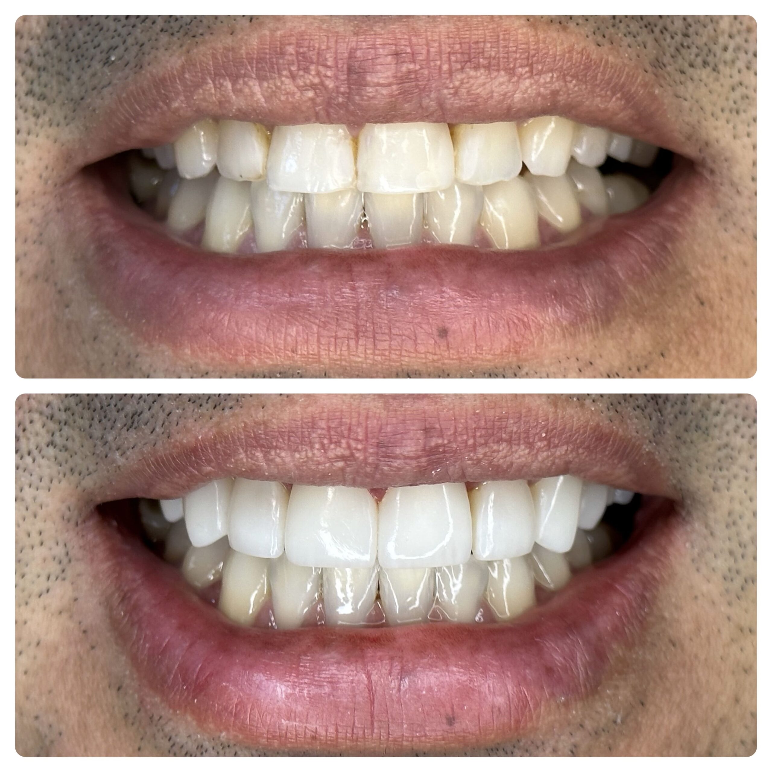clínica odontolife gama - transformação 4