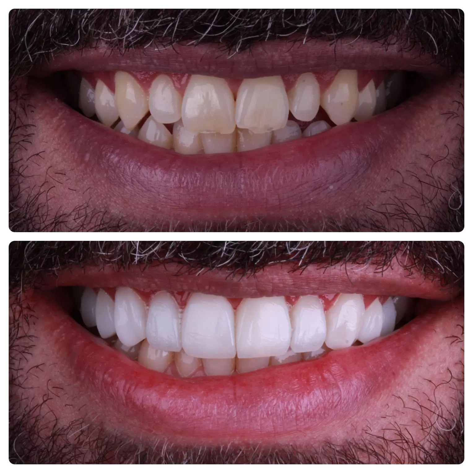 clínica odontolife gama - transformação 1