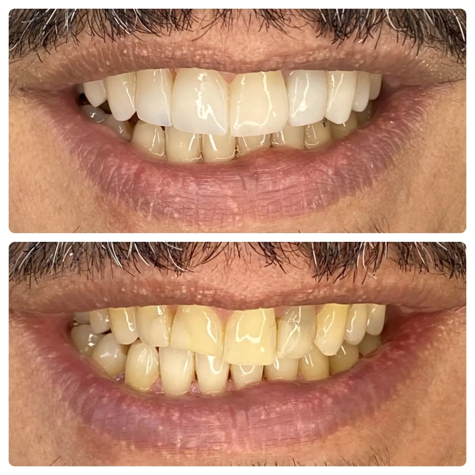 clínica odontolife gama - transformação 2