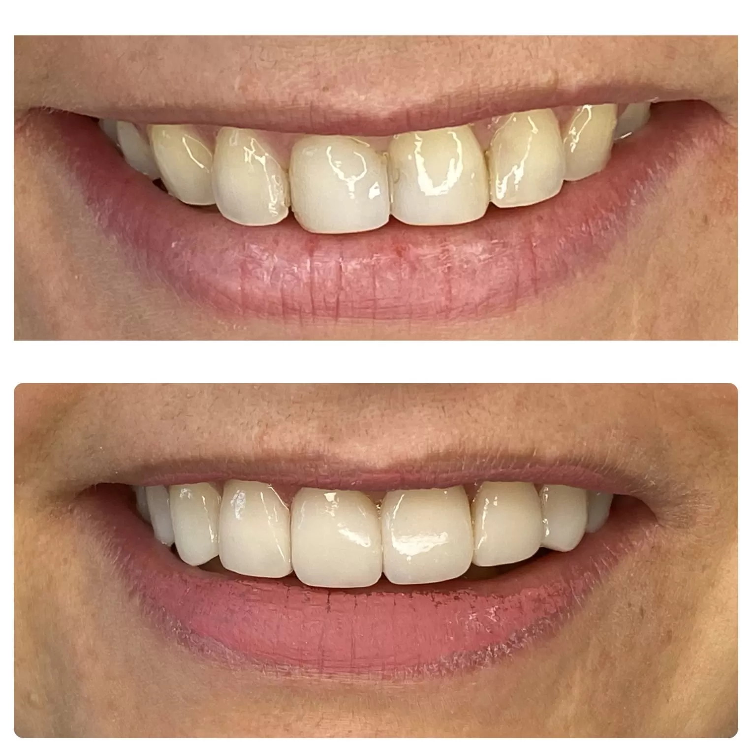 clínica odontolife gama - transformação 3