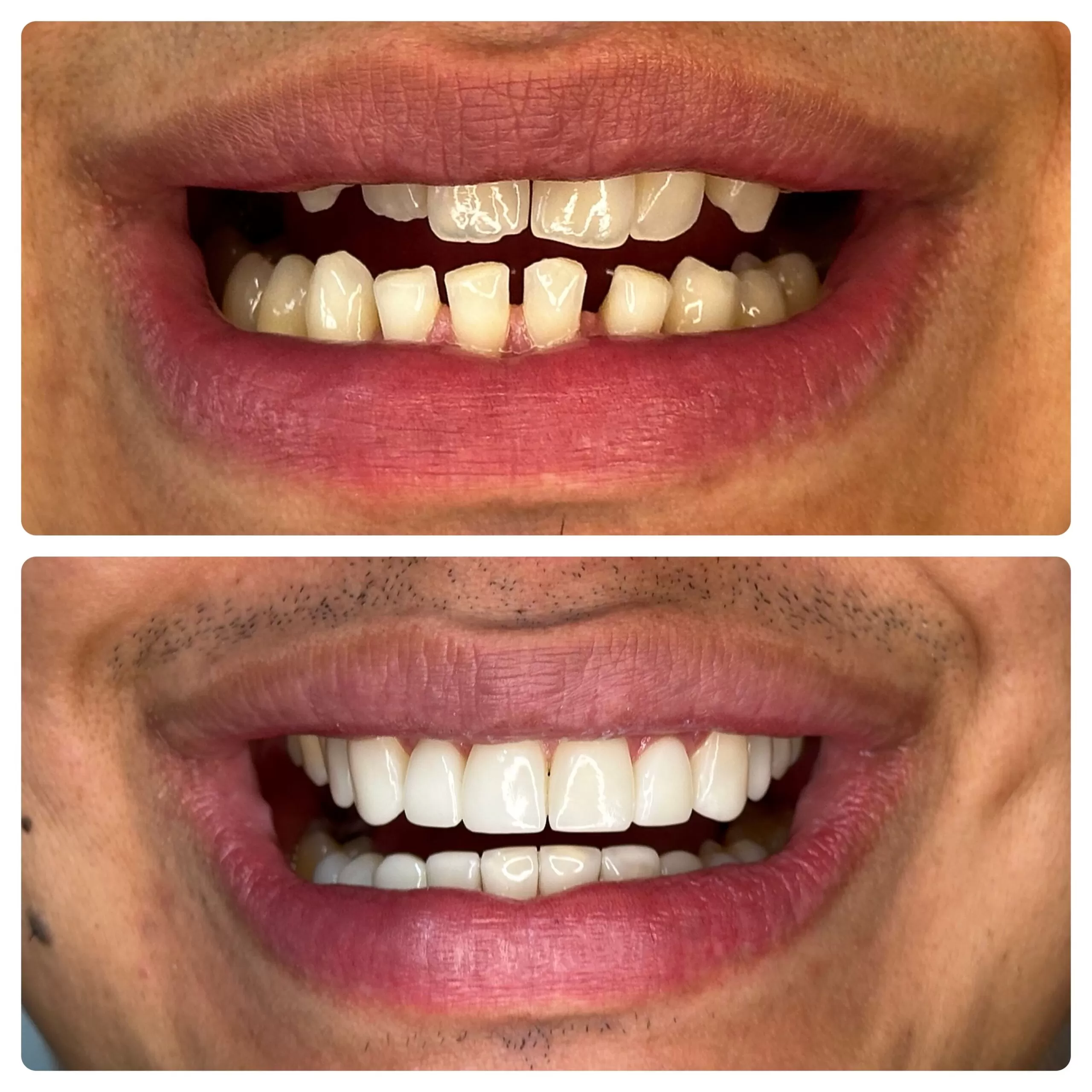 clínica odontolife gama - transformação 7