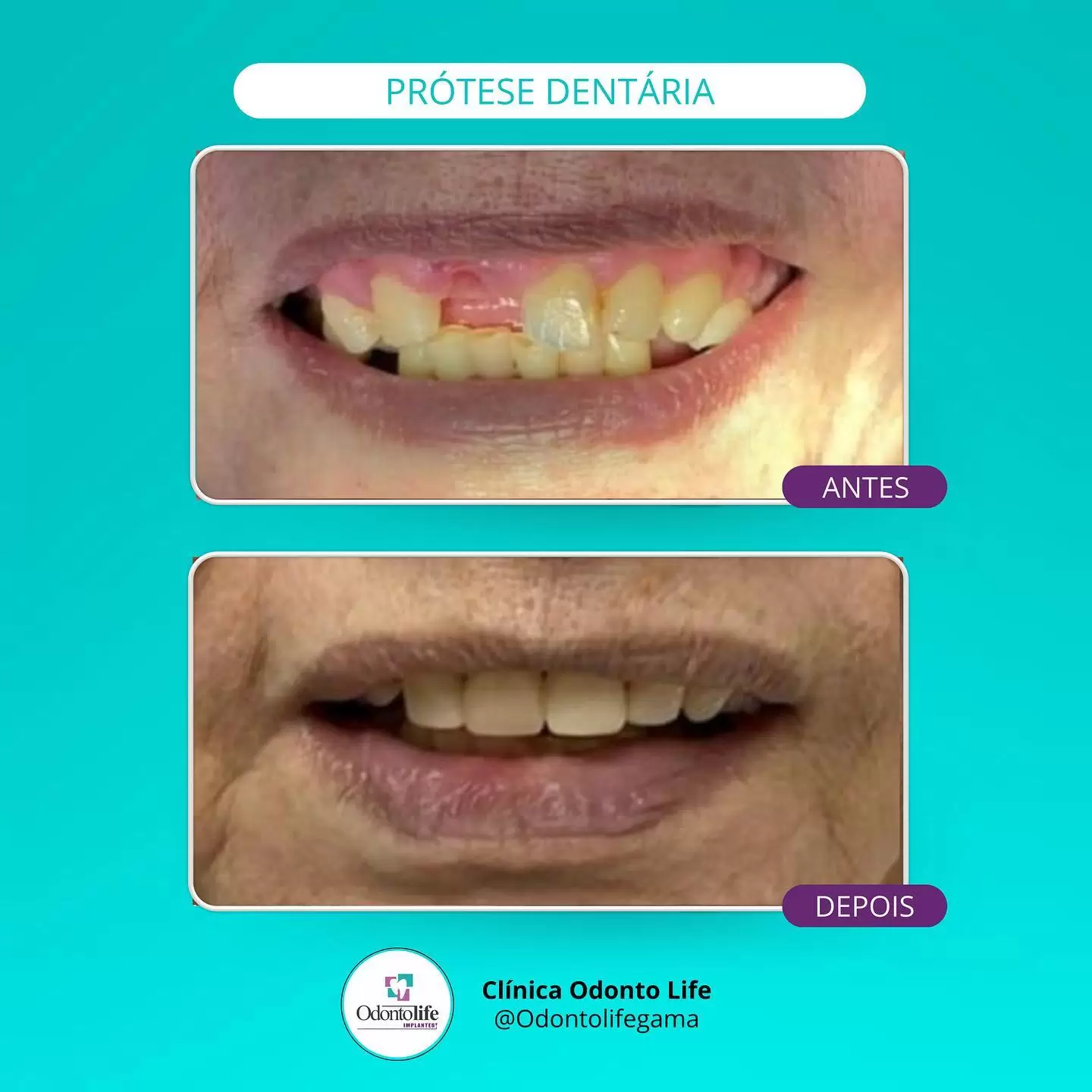 clínica odontolife gama - transformação 9